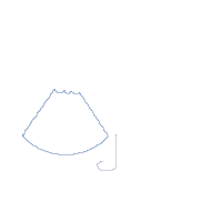 Sweet One Watermelon 1st Birthday - Applique - Machine Embroidery Design