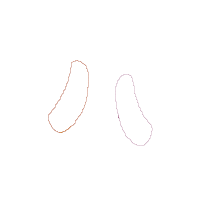 Ballerina Shoes - Applique