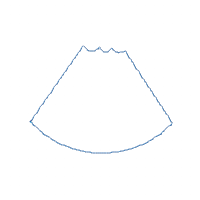 Summer Watermelon Slice and Butterflies - Applique