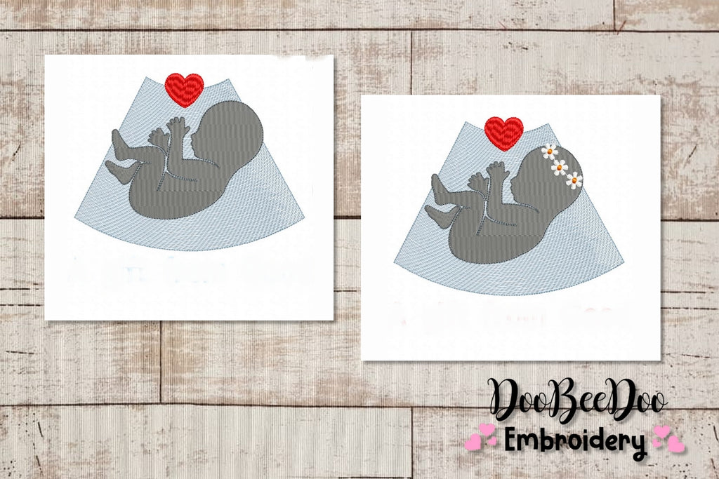 Baby Ultrasound - Girl and Boy - 6 Sizes - Machine Embroidery Designs