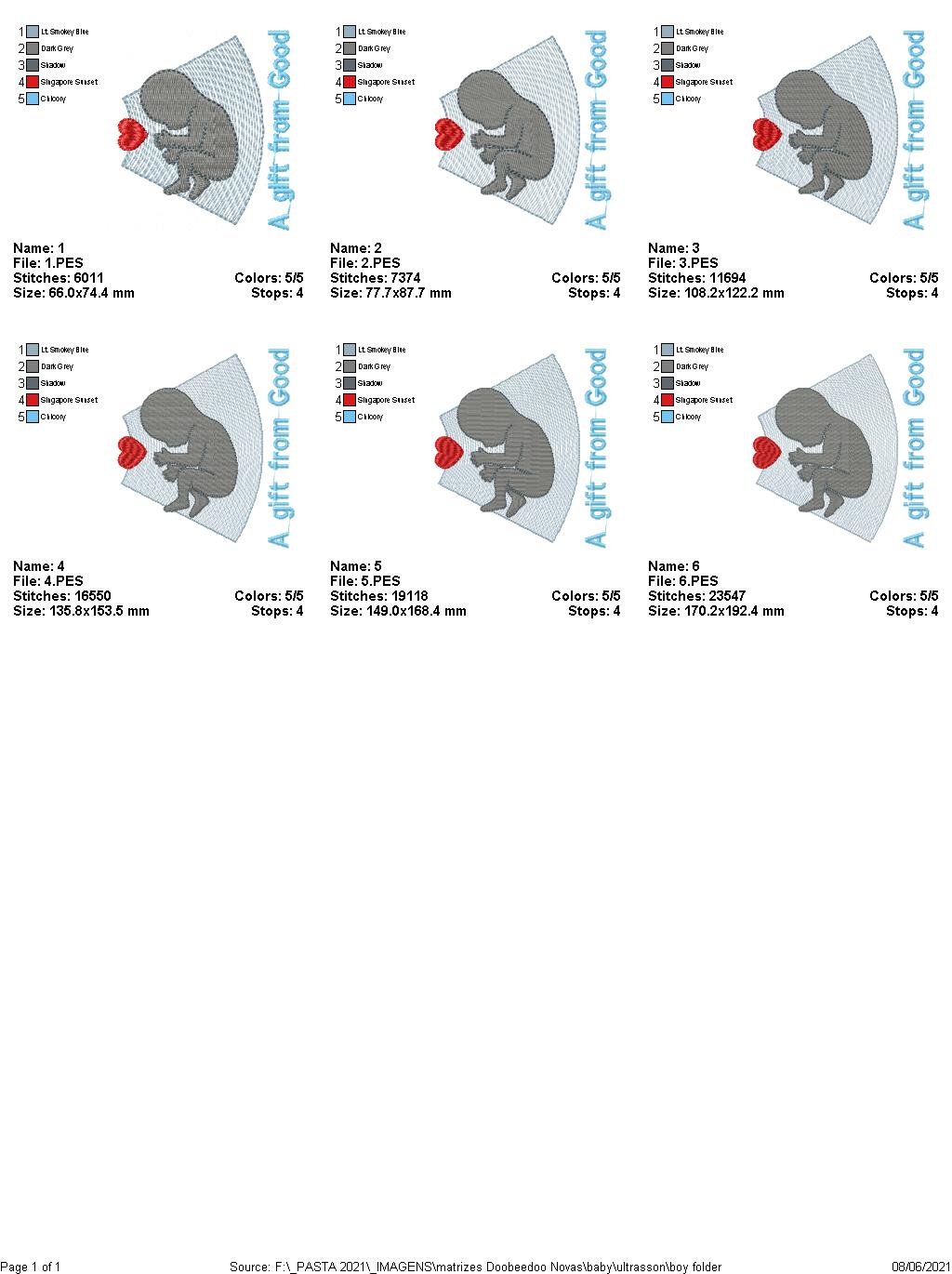 Baby Ultrasound - Girl and Boy - 6 Sizes - Machine Embroidery Designs