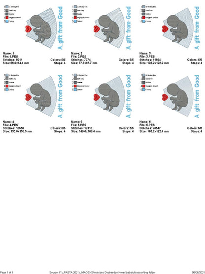 Baby Ultrasound - Girl and Boy - 6 Sizes - Machine Embroidery Designs